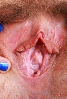 ATK hairy  in mature and hairy