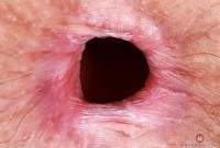 ATK hairy Jackie Hoff Set