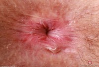 ATK hairy Jackie Hoff Set