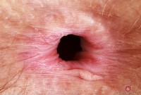 ATK hairy Jackie Hoff Set