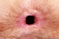 ATK hairy Jackie Hoff Set