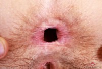 ATK hairy Jackie Hoff Set