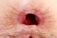 ATK hairy Jackie Hoff Set