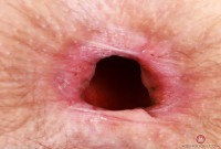 ATK hairy Jackie Hoff Set