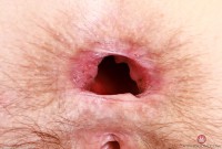 ATK hairy Jackie Hoff Set