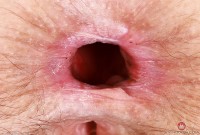 ATK hairy Jackie Hoff Set