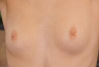 ATK hairy Zoey Kush Set