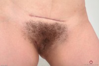 ATK hairy  in young and hairy