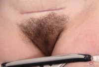 ATK hairy  in young and hairy