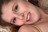 ATK hairy  in young and hairy