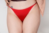 ATK hairy  in mature and hairy