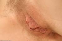 ATK hairy  in young and hairy