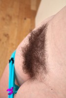 ATK hairy  in mature and hairy