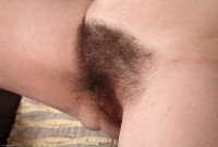 ATK hairy  in mature and hairy