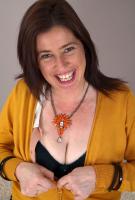 ATK hairy  in mature and hairy