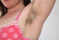 ATK hairy  in mature and hairy