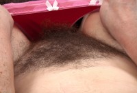 ATK hairy  in mature and hairy