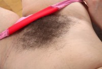 ATK hairy  in mature and hairy