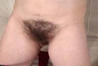 ATK hairy  in mature and hairy