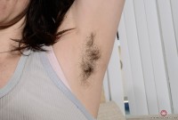 ATK hairy  in mature and hairy