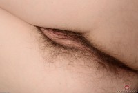 ATK hairy  in mature and hairy