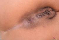 ATK hairy  in young and hairy