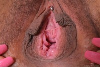 ATK hairy  in young and hairy
