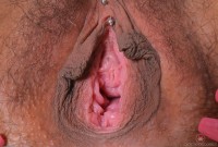 ATK hairy  in young and hairy