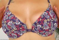 ATK hairy  in mature and hairy