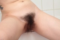 ATK hairy  in young and hairy