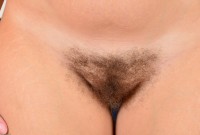 ATK hairy  in young and hairy