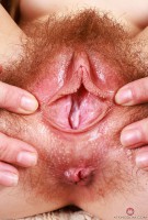 ATK hairy  in young and hairy