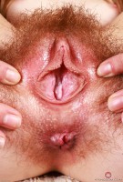ATK hairy  in young and hairy