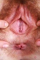 ATK hairy  in young and hairy