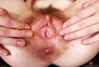 ATK hairy  in young and hairy