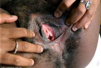 ATK hairy  in exotic and hairy