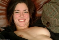 ATK hairy  in young and hairy