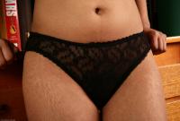 ATK hairy Joslin Set