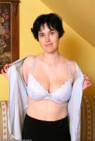 ATK hairy  in mature and hairy