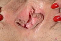 ATK hairy  in young and hairy