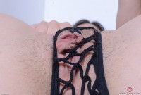 ATK hairy  in young and hairy