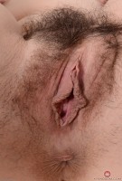 ATK hairy  in young and hairy