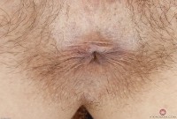 ATK hairy  in young and hairy