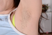 ATK hairy  in mature and hairy