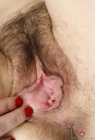 ATK hairy  in mature and hairy