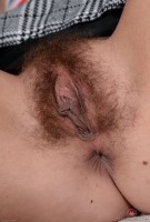 ATK hairy  in young and hairy