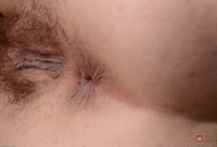 ATK hairy  in young and hairy