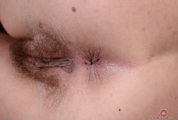 ATK hairy  in young and hairy