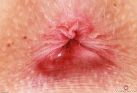 ATK hairy Kallie Taylor Set