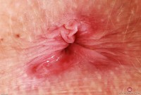 ATK hairy Kallie Taylor Set